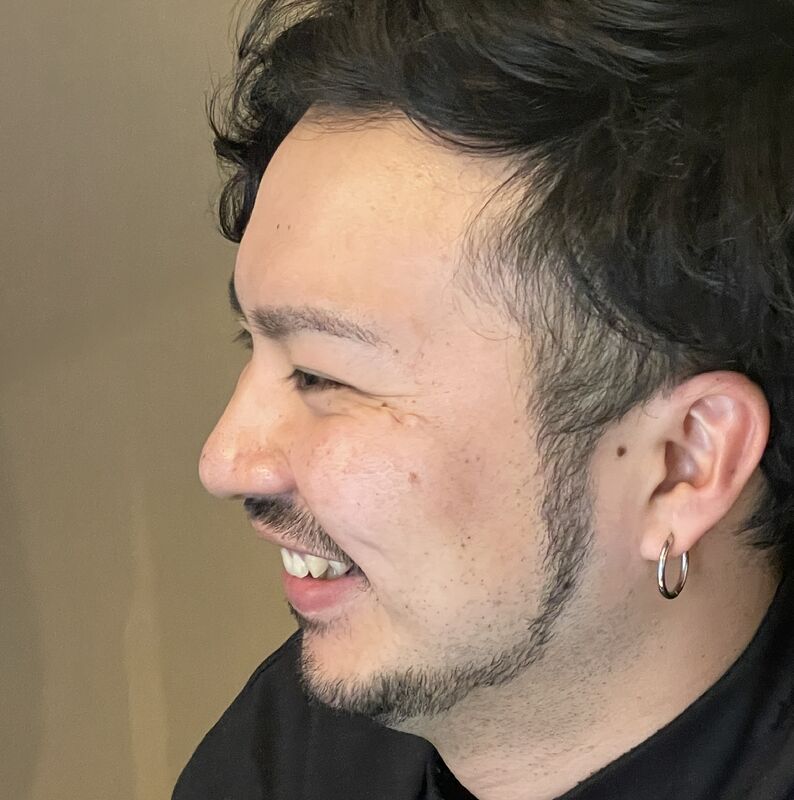 デザイン脱毛